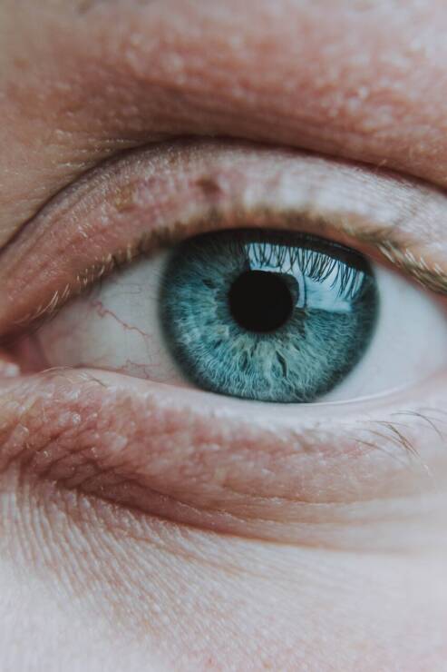 Glaukoma – akių liga, kurios padariniai negrįžtami