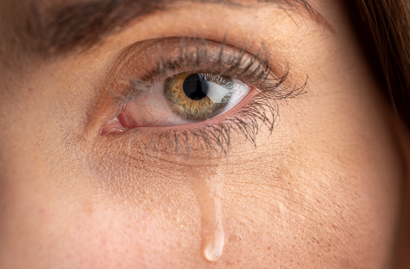 Ašarojančios akys – ne vienintelis alerginio konjunktyvito požymis